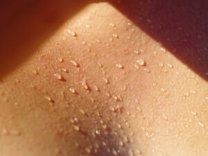 sweat on skin